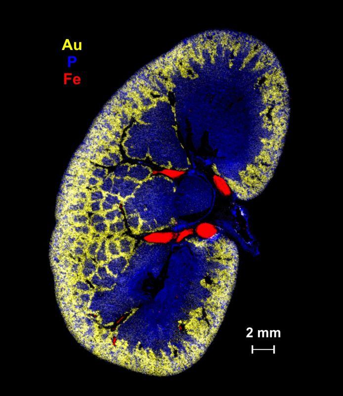 Elemental images obtained by laser-induced breakdown spectroscopy showing the bio-distribution of Iron (Fe), Phosphorous (P) and Gold (Au) in a murine kidney