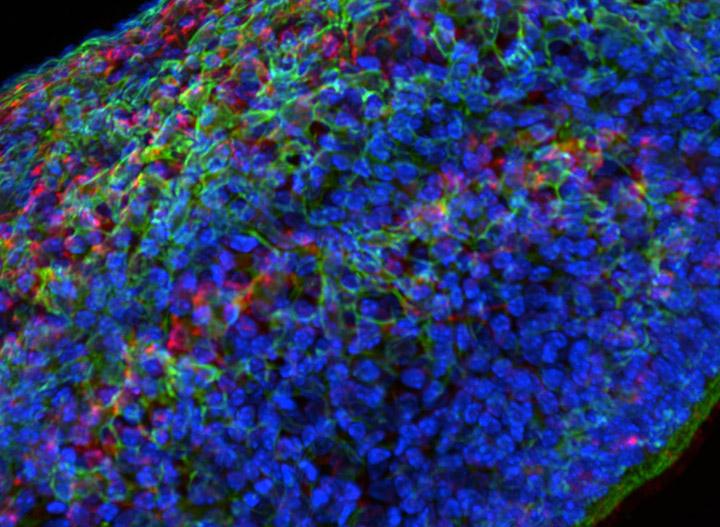 A developing zebrafish embryo imaged from 4 to 18 hours post fertilization where each cell nucleus is labelled with Courtesy of Gopi Shah‚ MPI-CBG, Dresden