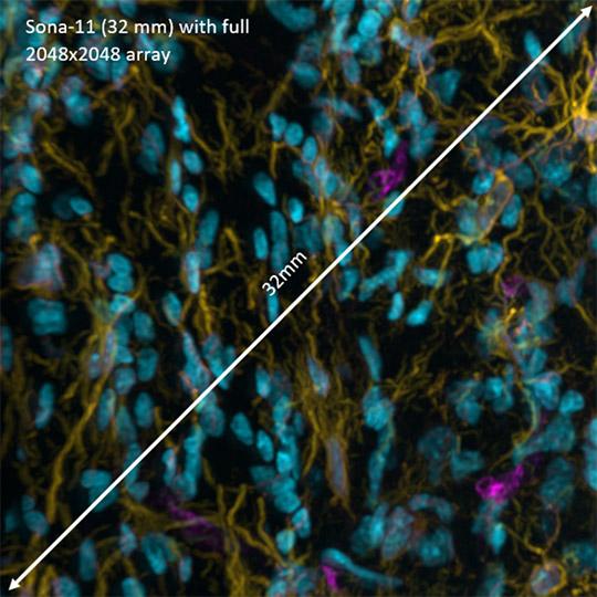 Sona sCMOS with 2048 x 2048 full array